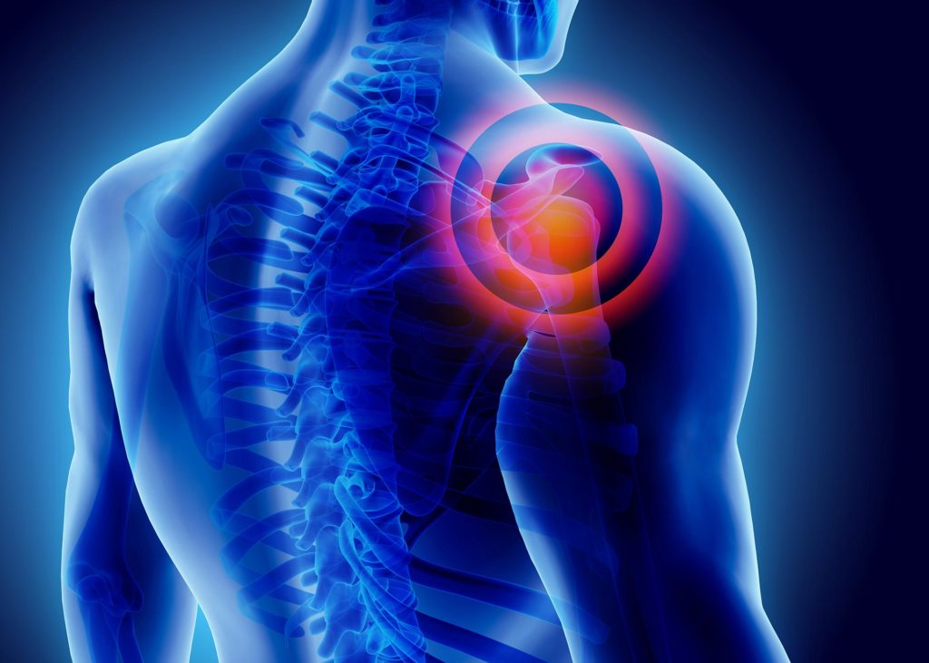 forzen Shoulder Treatment